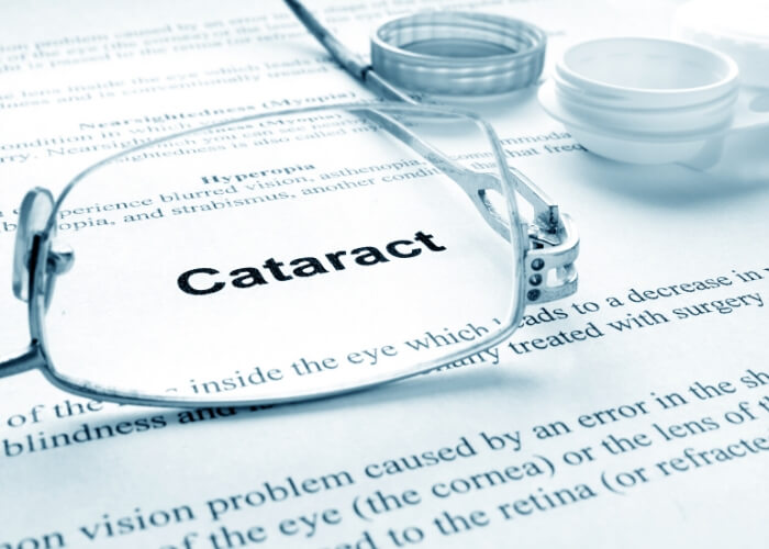 Pair of glasses laying on paperwork with the word "Cataract" in focus through the lens